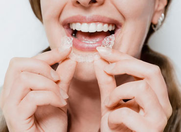 Ortodoncia Invisible en Pachuca