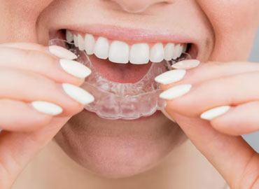 Ortodoncia Invisible en Pachuca